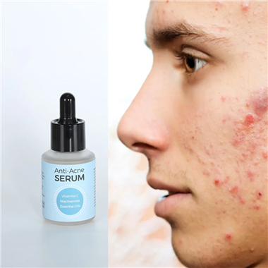 Vitamin C Serum