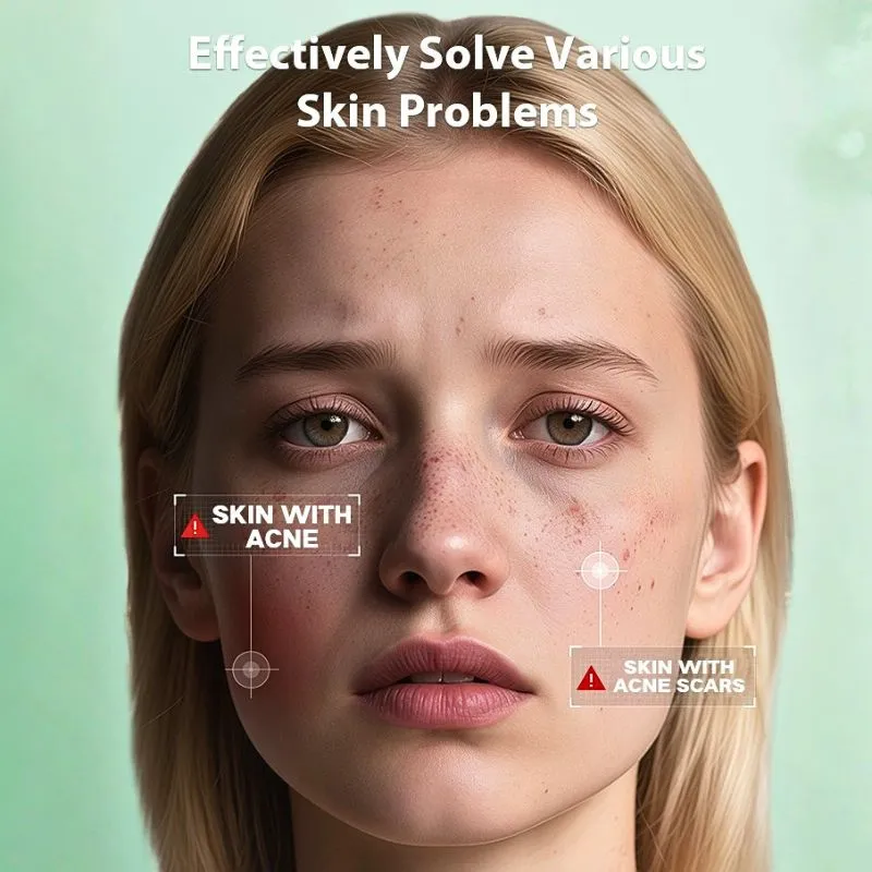 Microneedle acne patch 6 Microneedle acne patch 6