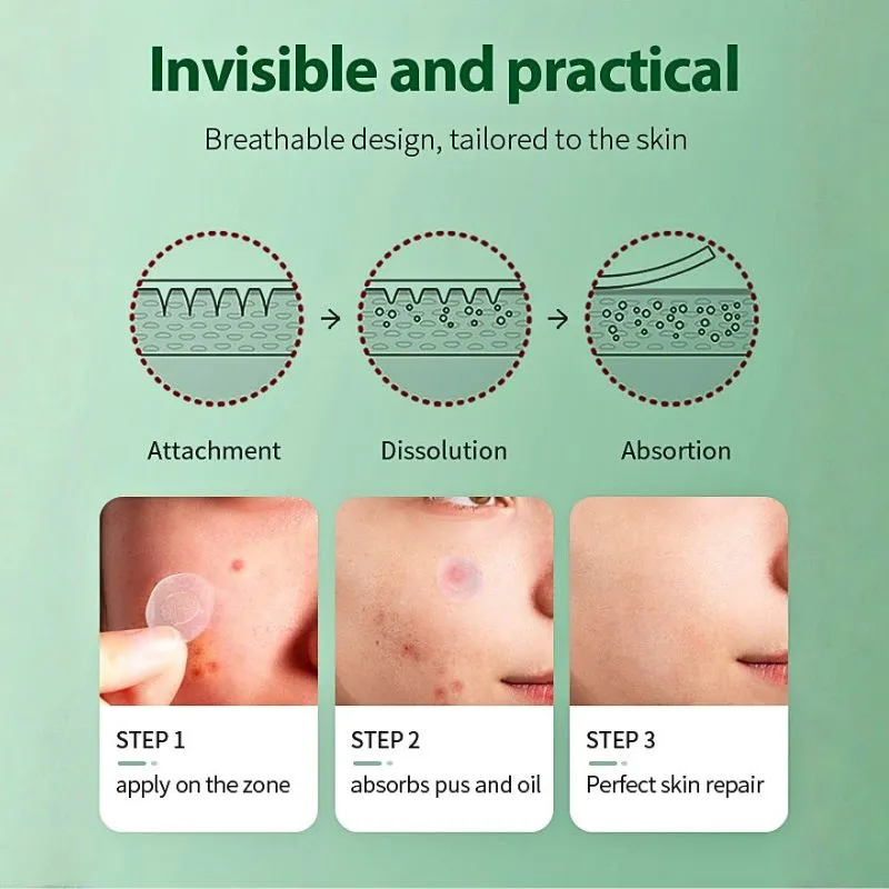 Microneedle acne patch 7 Microneedle acne patch 7