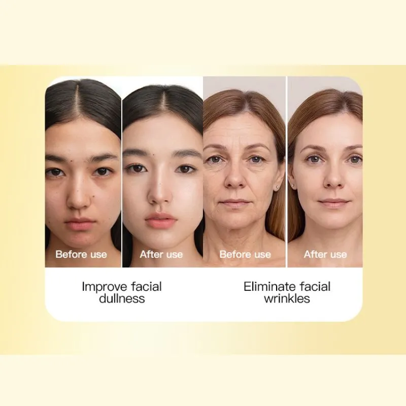 Turmeric mask 13 Turmeric mask 13